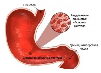 Категория годности 